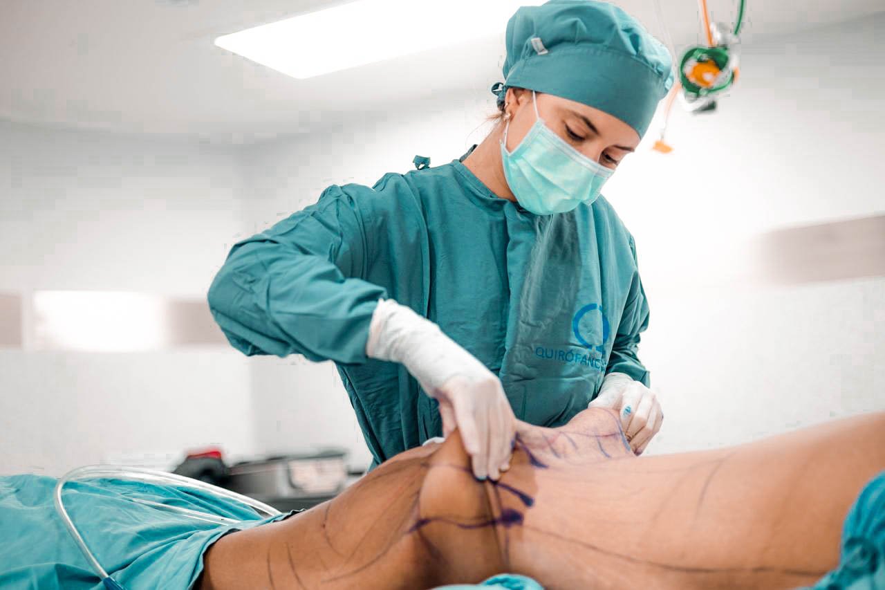 Liposucción: cuándo es suficiente y cuándo necesita combinarse con otra cirugía